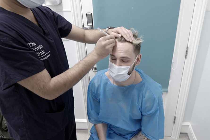 Phase one of your hair restoration procedure