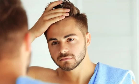 FUE Hair transplant Results in delhi